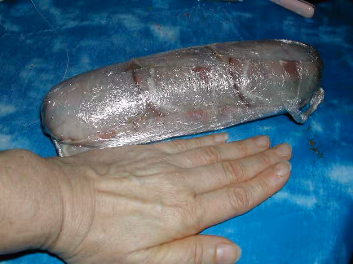 Blancde poulet au bacon
